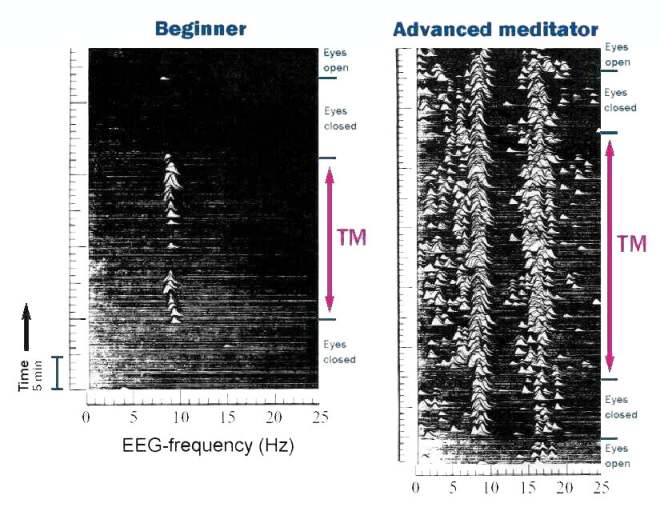 EEG signal after TM